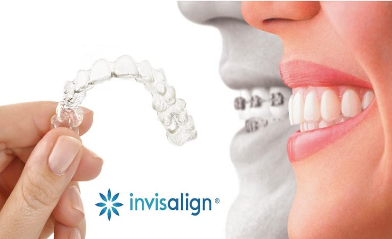 invisalign port washington long island
